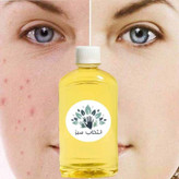 روغن ضد جوش 180cc کیفیت تضمینی