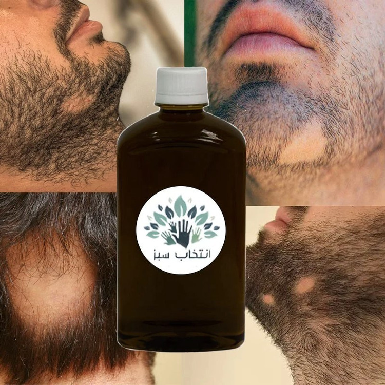 روغن ضد ریزش سکه ای 180cc کیفیت تضمینی