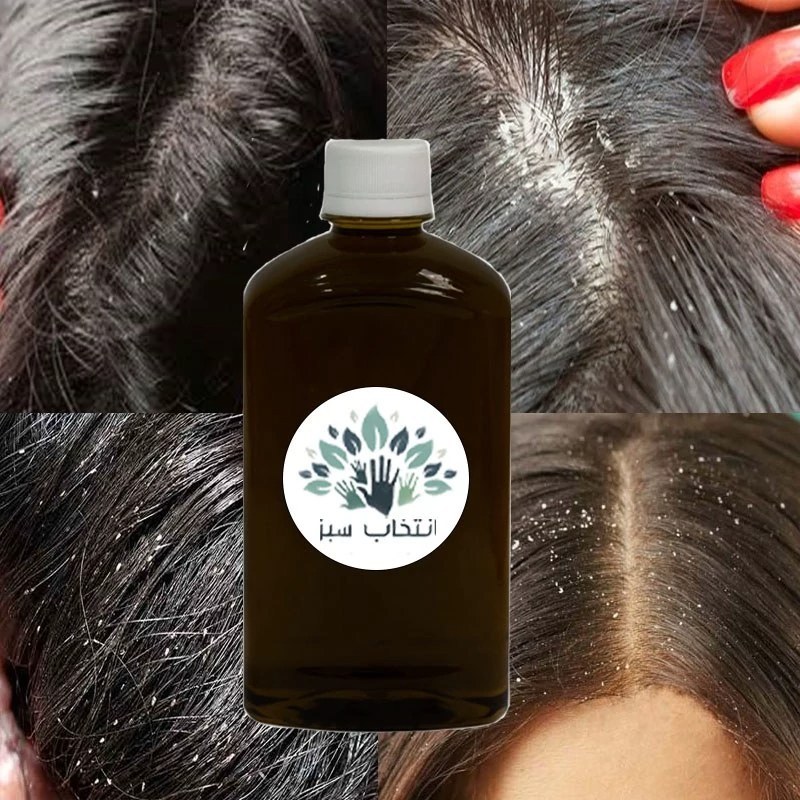 روغن ضد شوره 180cc با کیفیت تضمینی