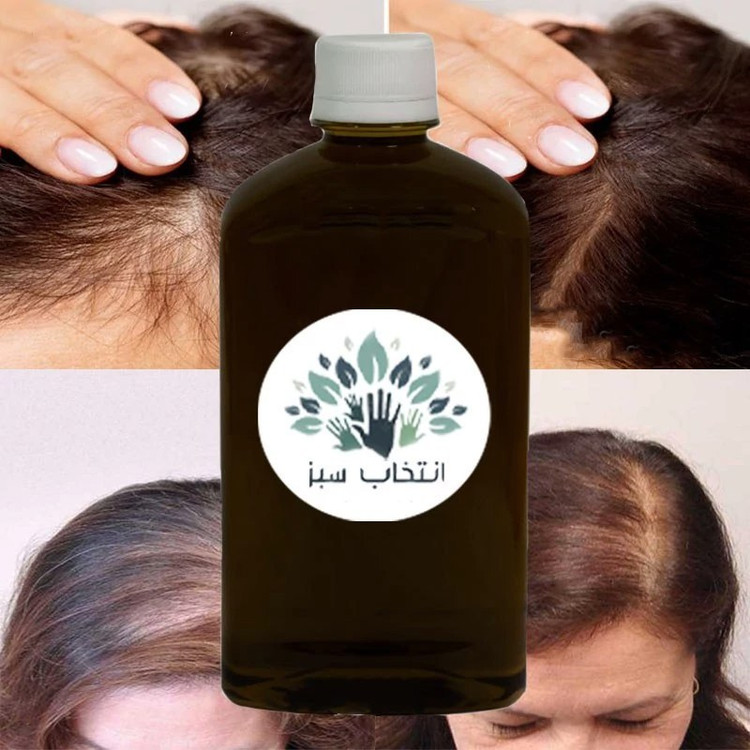 روغن تقویت مو180 cc(برای جلوگیری از ریزش مو پرپشتی مو ضخامت مو) (کیفیت تضمینی)